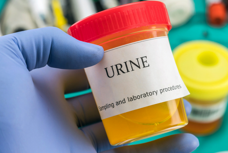 Uitscheiding- Urine