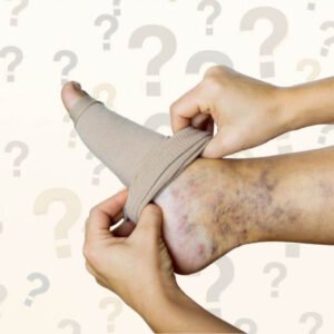 Hoe werken steunkousen? 1 hoe werken steunkousen