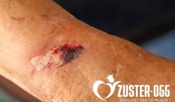 Skin Tear